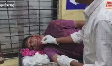 दिनदहाड़े SDOP पर चाकू से हुआ हमला; पहले किया 350 किमी पीछा,चेहरा कटा, सिर-गले पर गंभीर चोट; पुरानी रंजिश में वारदात, दुर्ग के रहने वाले हैं आरोपी