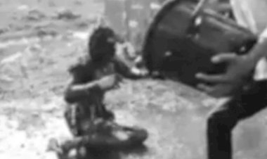 युवती ने पेट्रोल डालकर खुद को लगाई आग:गंभीर हालत में भोपाल के हमीदिया अस्पताल रैफर