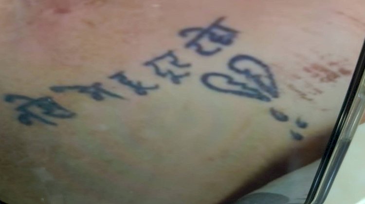 महिला के शरीर पर लिखा था नशे में हूं, दूर रहो, अर्धनग्न और घायल अवस्था में मिली,अस्पताल में भर्ती; सीसीटीवी खंगाल रही पुलिस