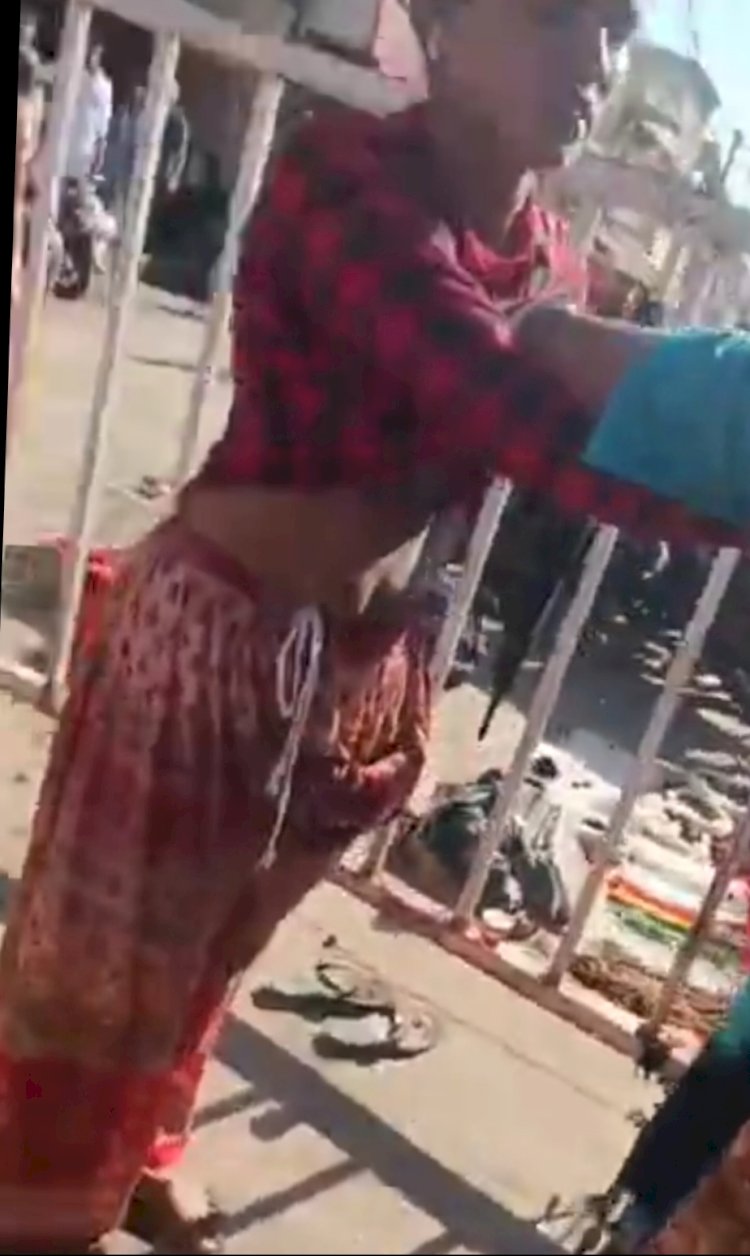 महाकाल मंदिर के बाहर सनसनी: पिता ने बेटी पर किया चाकू से हमला, घायल बोली– 5 लाख में शादी कर बेचने की बात करता था; 16 साल पहले छोड़ गया था